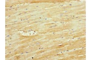 Immunohistochemistry of paraffin-embedded human heart tissue using ABIN7149113 at dilution of 1:100 (UQCRC1 抗体  (AA 1-63))