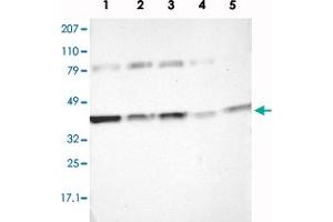 Western blot analysis of Lane 1: RT-4, Lane 2: EFO-21, Lane 3: A-431, Lane 4: Liver, Lane 5: Tonsil with IDH3G polyclonal antibody  at 1:250-1:500 dilution. (IDH3G 抗体)