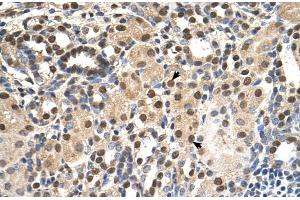 Immunohistochemistry (IHC) image for anti-Acidic (Leucine-Rich) Nuclear phosphoprotein 32 Family, Member E (ANP32E) (Middle Region) antibody (ABIN2782591)