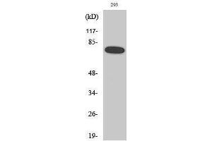 Western Blotting (WB) image for anti-Nuclear Factor-kB p65 (NFkBP65) (pSer468) antibody (ABIN3172939) (NF-kB p65 抗体  (pSer468))
