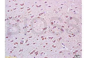 Formalin-fixed and paraffin embedded rat brain tissue labeled Anti-PEGF Polyclonal Antibody, Unconjugated (ABIN672456) at 1:200, followed by conjugation to the secondary antibody and DAB staining (PEDF 抗体  (AA 201-300))