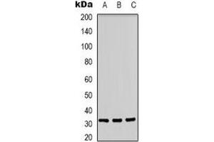 Western blot analysis of CD300f expression in A431 (A), Jurkat (B), PC12 (C) whole cell lysates. (IREM1 抗体)