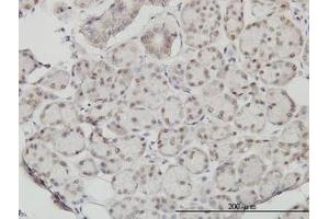 Image no. 1 for anti-Slingshot Homolog 3 (SSH3) (AA 293-392) antibody (ABIN599261) (SSH3 抗体  (AA 293-392))