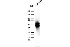 Western Blot Analysis of human spleen tissue lysate using Thymidine Phosphorylase Rabbit Recombinant Monoclonal (TYMP/2890R). (Recombinant Thymidine Phosphorylase 抗体)