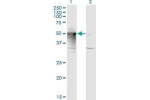 Western Blot analysis of ARMC6 expression in transfected 293T cell line by ARMC6 monoclonal antibody (M03), clone 2H8. (ARMC6 抗体  (AA 1-476))
