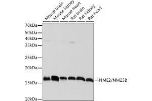 Western blot analysis of extracts of various cell lines, using NME2/NM23B Rabbit mAb (ABIN7269056) at 1:1000 dilution. (NME2 抗体)