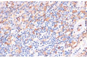 Immunohistochemistry of paraffin-embedded Human tonsil using CYBA Polyclonal Antibody at dilution of 1:100 (40x lens). (CYBA 抗体)