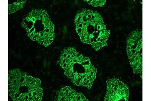 Image no. 1 for anti-Keratin 8 (KRT8) antibody (ABIN335327) (KRT8 抗体)