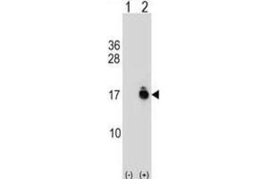 Western Blotting (WB) image for anti-Acylphosphatase 1, Erythrocyte (Common) Type (Acyp1) antibody (ABIN2999420) (ACYP1 抗体)