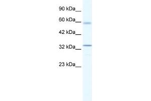 WB Suggested Anti-ZBTB7A Antibody Titration:  1. (ZBTB7A 抗体  (Middle Region))