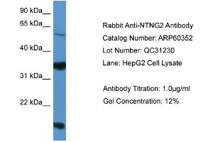 WB Suggested Anti-NTNG2  Antibody Titration: 0. (Netrin G2 抗体  (Middle Region))