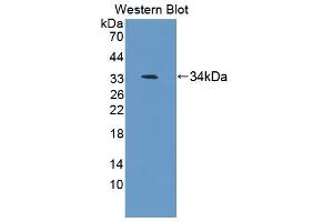 Western blot analysis of the recombinant protein. (Antizyme Inhibitor 1 抗体  (AA 1-280))