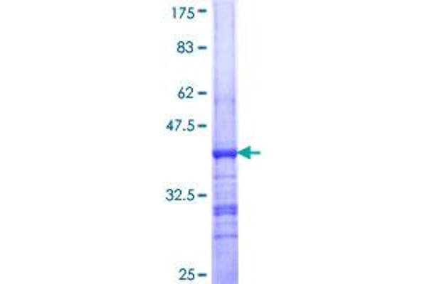 TUBA1A Protein (AA 352-451) (GST tag)