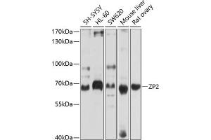 Western blot analysis of extracts of various cell lines, using ZP2 antibody (ABIN6128965, ABIN6150534, ABIN6150535 and ABIN6214263) at 1:1000 dilution. (ZP2 抗体  (AA 651-745))