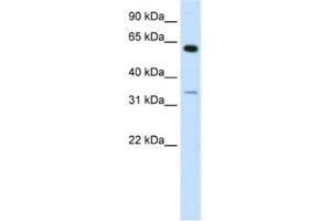 Western Blotting (WB) image for anti-Zinc Finger Protein 609 (ZNF609) antibody (ABIN2460279) (ZNF609 抗体)