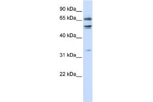 WB Suggested Anti-MED26 Antibody Titration:  0. (MED26 抗体  (N-Term))