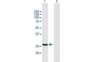 Western Blot analysis of RG9MTD1 expression in transfected 293T cell line by RG9MTD1 MaxPab polyclonal antibody. (RG9MTD1 抗体  (AA 1-252))