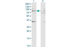 Western Blot analysis of BAZ2B expression in transfected 293T cell line by BAZ2B monoclonal antibody (M07), clone 2D10. (BAZ2B 抗体  (AA 1833-1931))