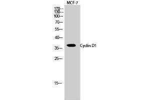 Western Blotting (WB) image for anti-Cyclin D1 (CCND1) (Ser166) antibody (ABIN3174618) (Cyclin D1 抗体  (Ser166))