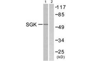 Western blot analysis of extracts from 293 cells, treated with heat shock, using SGK (Ab-78) Antibody. (SGK1 抗体  (AA 41-90))
