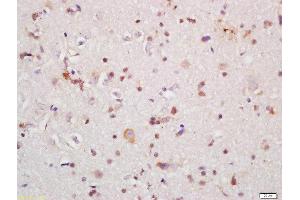 Immunohistochemistry (Paraffin-embedded Sections) (IHC (p)) image for anti-Interleukin-1 Receptor-Associated Kinase 1 (IRAK1) (AA 301-400) antibody (ABIN1387749)