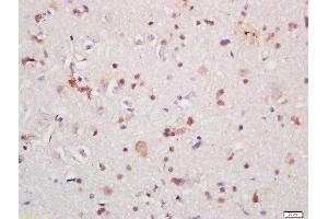 Formalin-fixed and paraffin embedded rat brain labeled with Rabbit Anti-IRAK1 Polyclonal Antibody, Unconjugated (ABIN1387749) at 1:200 followed by conjugation to the secondary antibody and DAB staining (IRAK1 抗体  (AA 301-400))