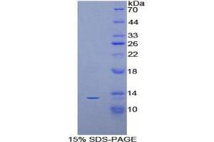 SDS-PAGE analysis of Mouse AIF1 Protein. (Iba1 蛋白)