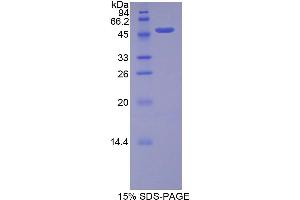 SDS-PAGE analysis of Rat FGF10 Protein. (FGF10 蛋白)