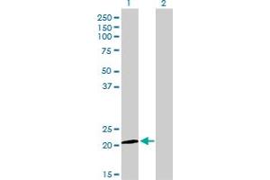 Western Blot analysis of ATF3 expression in transfected 293T cell line by ATF3 monoclonal antibody (M01), clone 6B8. (ATF3 抗体  (AA 1-181))