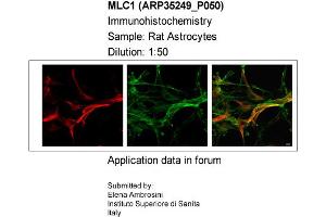 Sample Type: Rat AstrocytesDilution: 1:50 (MLC1 抗体  (Middle Region))
