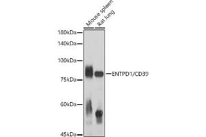 Western blot analysis of extracts of various cell lines, using ENTPD1/CD39 antibody (ABIN1679729, ABIN3018088, ABIN3018089 and ABIN6220354) at 1:1000 dilution. (CD39 抗体  (AA 1-180))