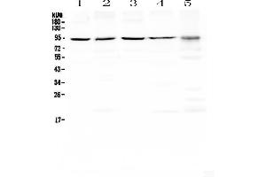 Western blot analysis of PRDM1/Blimp1 using anti-PRDM1/Blimp1 antibody . (PRDM1 抗体  (AA 1-230))