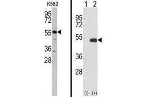 (LEFT) Western blot analysis of GPT antibody (N-term R133) in K562 cell line lysates (35 µg/lane). (ALT 抗体  (N-Term))
