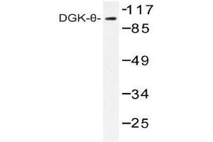 Western blot (WB) analysis of DGK-theta antibody in extracts from HT-29 cells. (DGKQ 抗体)