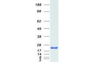 Western Blotting (WB) image for Nudix (Nucleoside Diphosphate Linked Moiety X)-Type Motif 2 (NUDT2) (Transcript Variant 3) protein (Myc-DYKDDDDK Tag) (ABIN2727758)