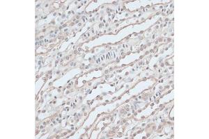 Immunohistochemistry of paraffin-embedded mouse kidney using ZNF597 antibody  at dilution of 1:100 (40x lens). (ZNF597 抗体  (AA 1-140))