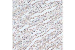 Immunohistochemistry of paraffin-embedded mouse kidney using ZNF597 antibody  at dilution of 1:100 (40x lens). (ZNF597 抗体  (AA 1-140))