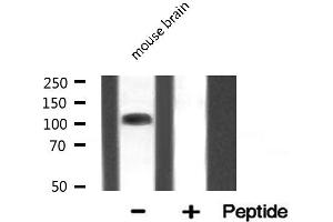 Western blot analysis of EIF4G2 expression in Mouse brain lysate (EIF4G2 抗体  (N-Term))