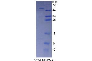 SDS-PAGE analysis of Mouse AASS Protein. (AASS 蛋白)