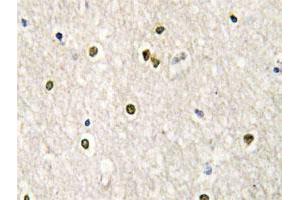 Immunohistochemical analysis of paraffin-embedded human brain tissue using MED17 polyclonal antibody . (MED17 抗体)