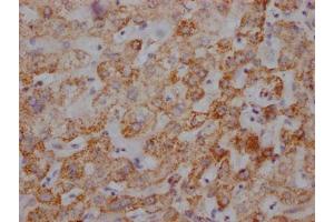 IHC image of ABIN7127865 diluted at 1:100 and staining in paraffin-embedded human liver tissue performed on a Leica BondTM system. (Recombinant UQCRC2 抗体)