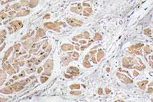 Immunohistochemical staining of paraffin-embedded human heart tissue with GNRH1 polyclonal antibody . (GNRH1 抗体)