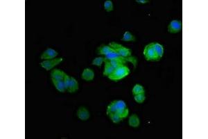 Immunofluorescent analysis of MCF-7 cells using ABIN7149238 at dilution of 1:100 and Alexa Fluor 488-congugated AffiniPure Goat Anti-Rabbit IgG(H+L) (CYP2B6 抗体  (AA 250-343))