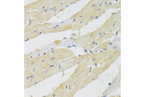 Immunohistochemistry of paraffin-embedded rat heart using TRAP1 Antibody (ABIN1875197) at dilution of 1:100 (40x lens). (TRAP1 抗体)