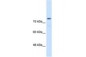 Image no. 1 for anti-Actinin, alpha 4 (ACTN4) (AA 800-849) antibody (ABIN6736629) (alpha Actinin 4 抗体  (AA 800-849))