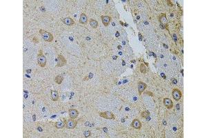 Immunohistochemistry of paraffin-embedded Mouse brain using Gm13125 Polyclonal Antibody at dilution of 1:100 (40x lens). (Pramel15 抗体)