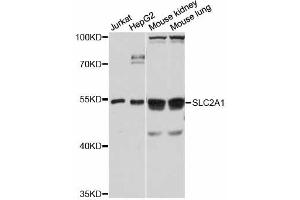 Western blot analysis of extracts of various cell lines, using SLC2A1 antibody. (GLUT1 抗体)
