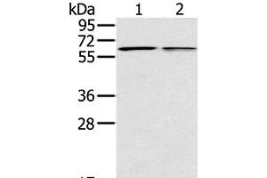 Western Blot analysis of Mouse liver and lung tissue using PTGER2 Polyclonal Antibody at dilution of 1:200 (PTGER2 抗体)