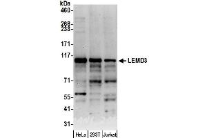 anti-LEM Domain Containing 3 (LEMD3) (AA 300-350) antibody