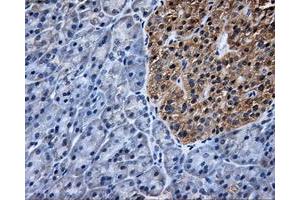 Immunohistochemical staining of paraffin-embedded Kidney tissue using anti-TTLL12mouse monoclonal antibody. (TTLL12 抗体)